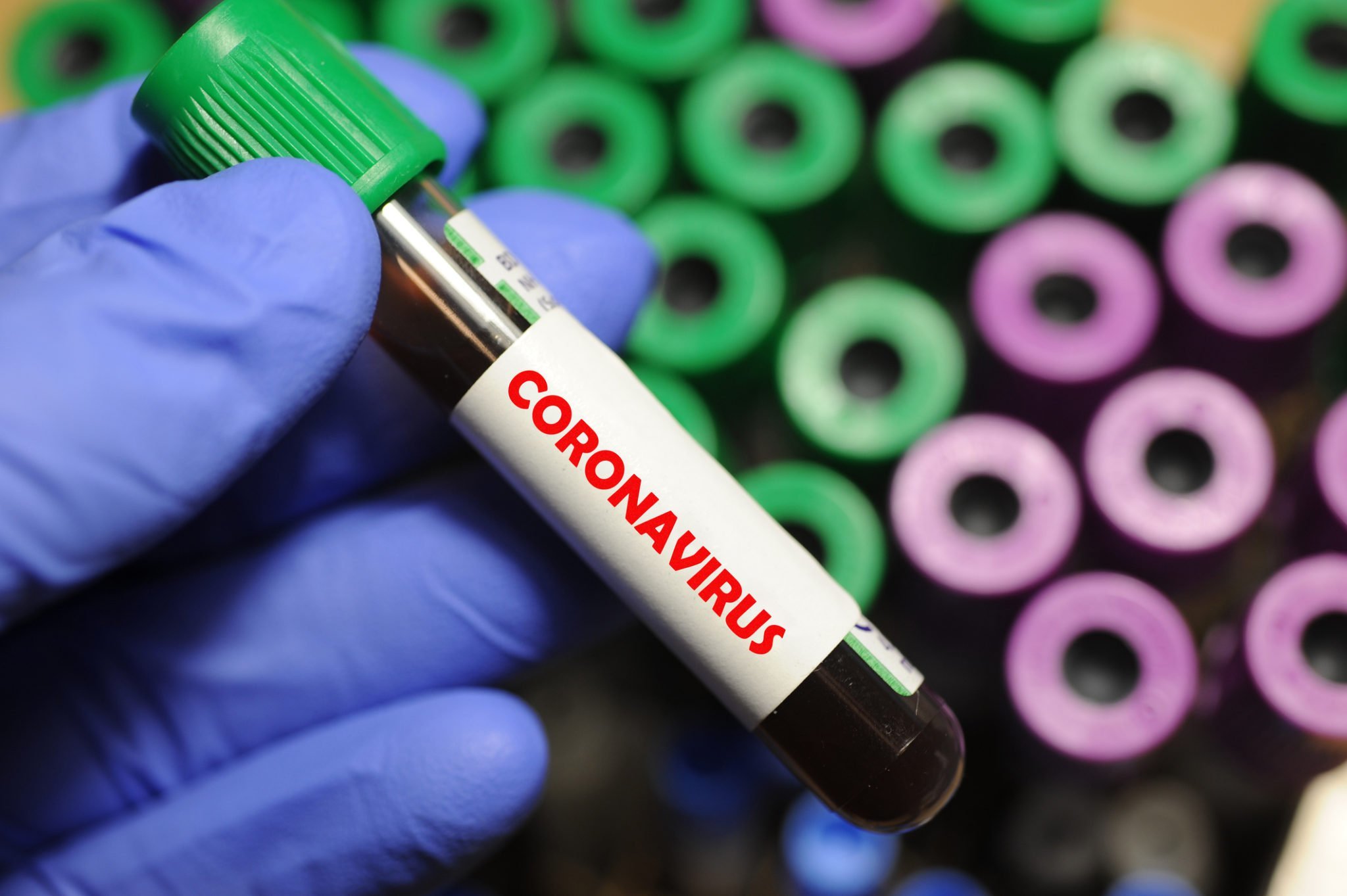 Israelul a dezvoltat un nou test pentru coronavirus care crește numărul persoanelor ce pot fi testat...