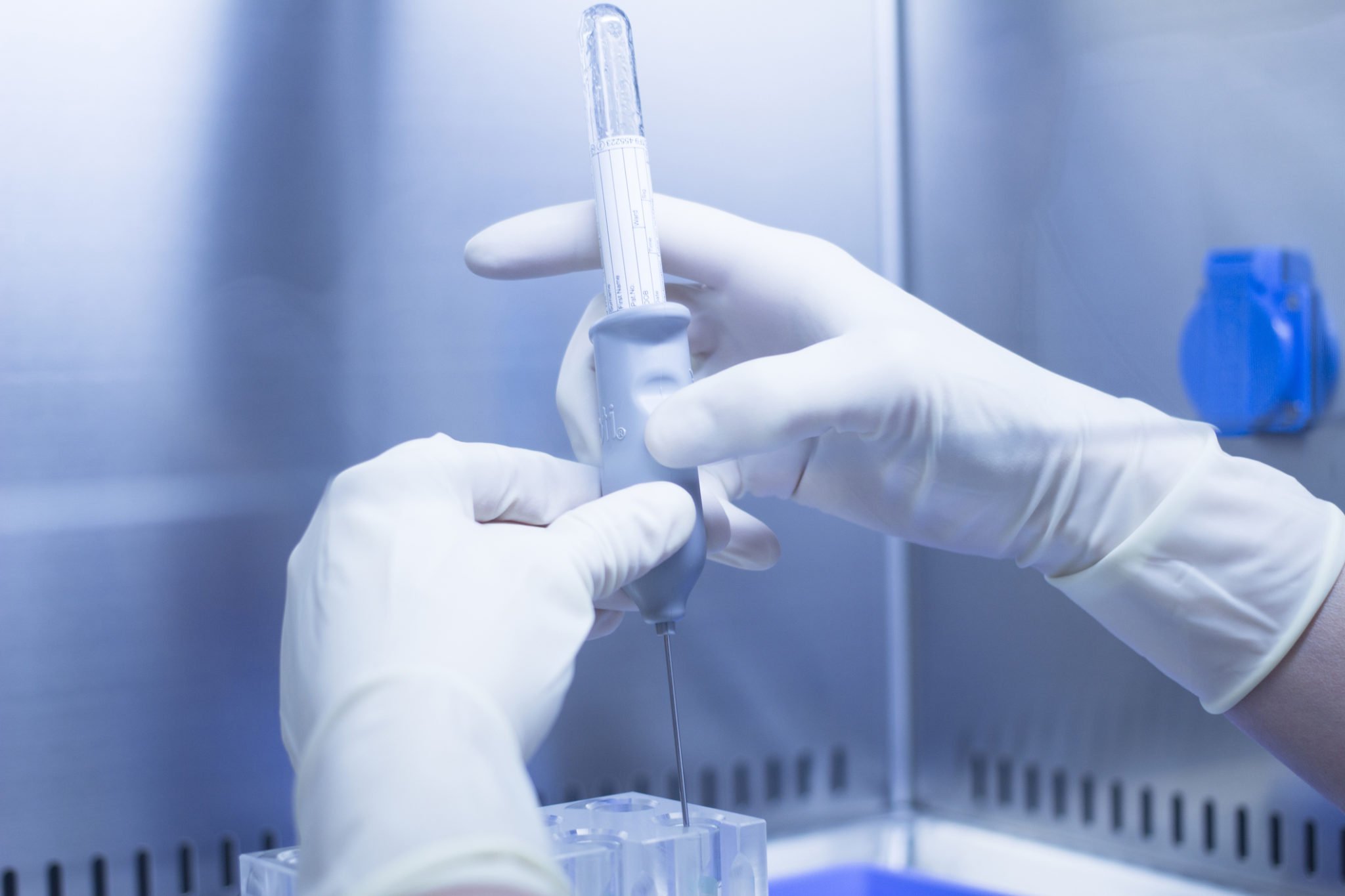 Plasma terapeutică, eficientă în bătălia cu Covid-19