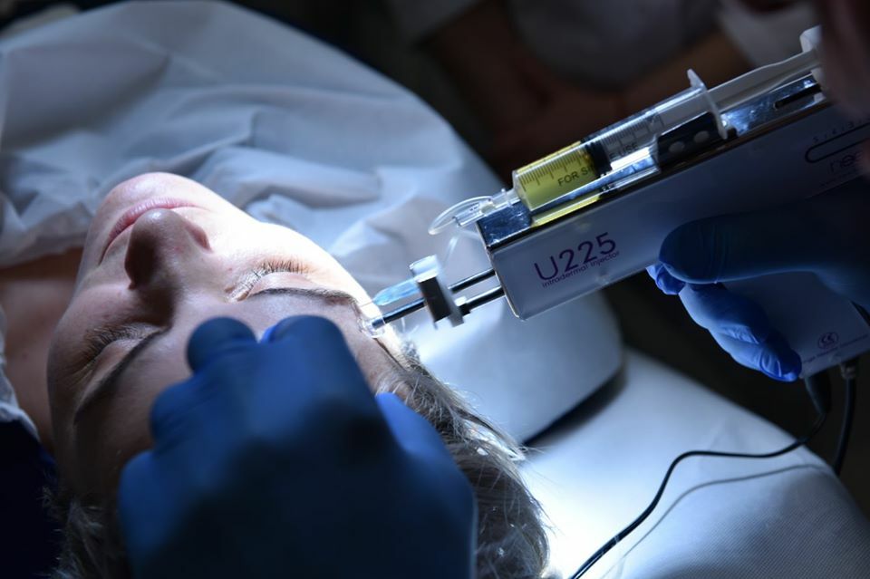 Ce presupune mezoterapia, una dintre cele mai eficiente tehnici de întinerire a pielii