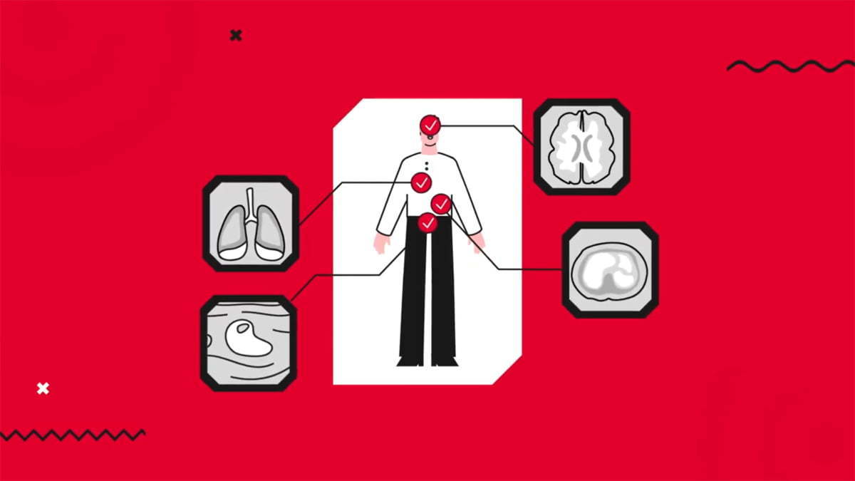 Cum a ajuns startup-ul fondat de Emi Gal să dezvolte o soluție care depistează leziunile pulmonare p...
