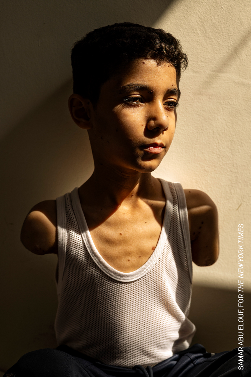 World Press Photo 2025: Imaginea anului spune povestea unui copil din Gaza 1 World Press Photo 2025