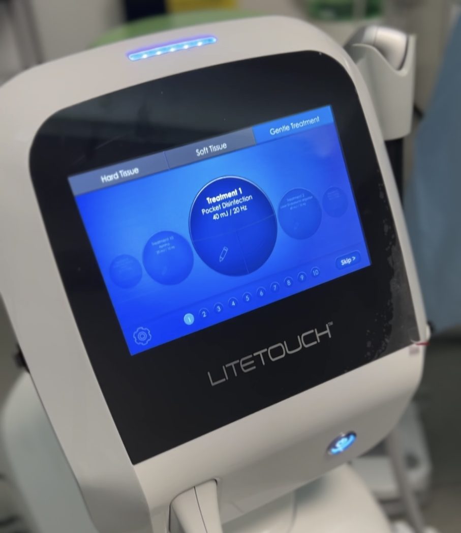 Laser Dent Medical, o rețea construită în jurul tehnologiei laser 3 IMG 6562 e1765894507786